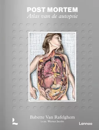 Cover van boek Post mortem: atlas van de autopsie